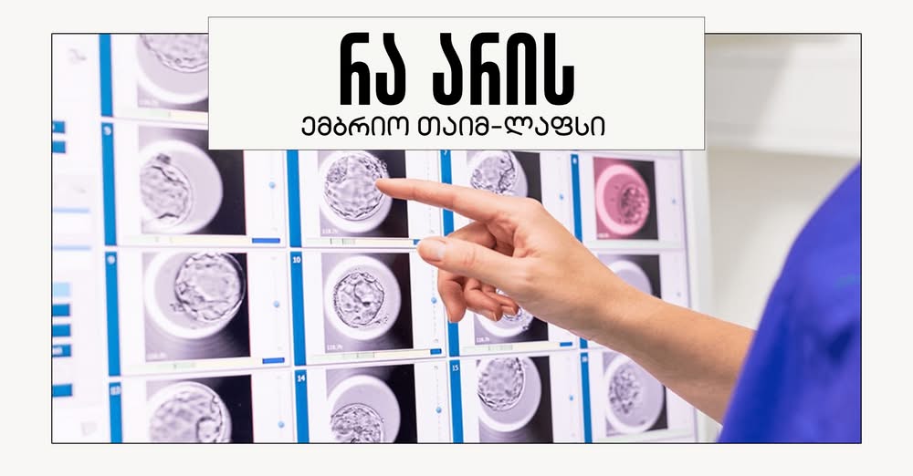 რა არის ემბრიო თაიმ-ლაფსი?